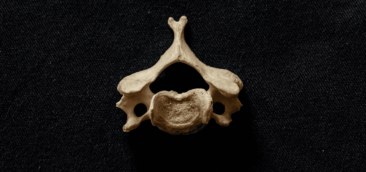 Cervical Spine Simulator